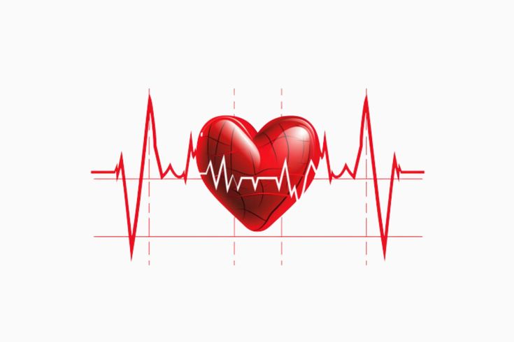 AVC_Maladies Cardio Vasculaire
